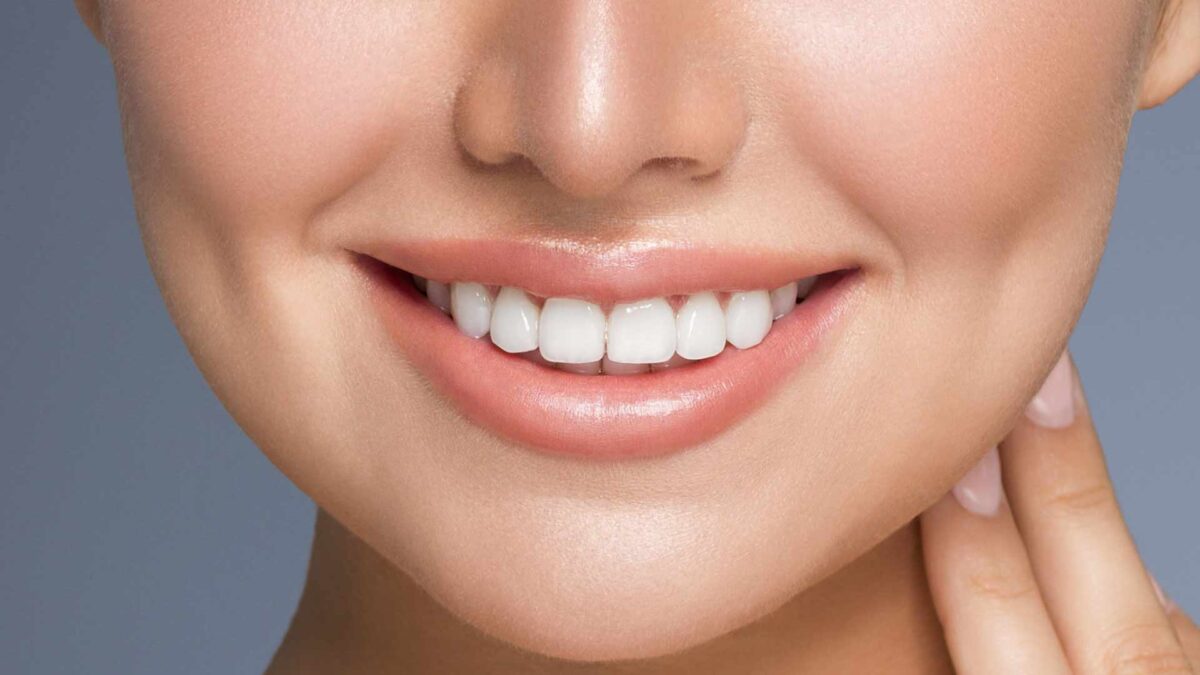 perfect teeth veneers in colombia