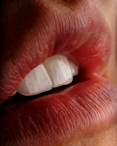 Extreme close-up of natural-looking porcelain veneers and textured lips, showing realistic translucency and surface detail of the dental work