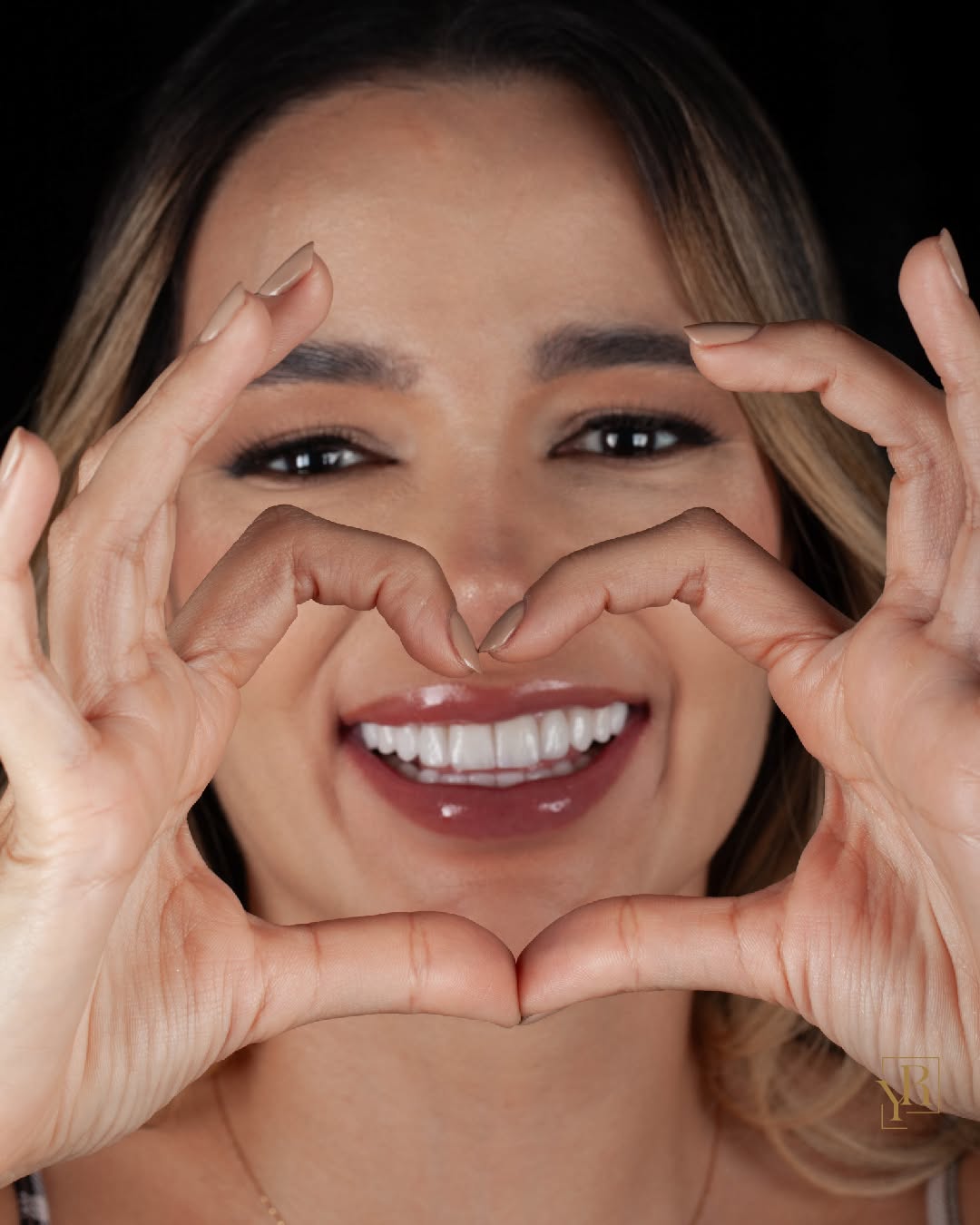 You are currently viewing Cheapest place to get veneers in the world (2026 guide)