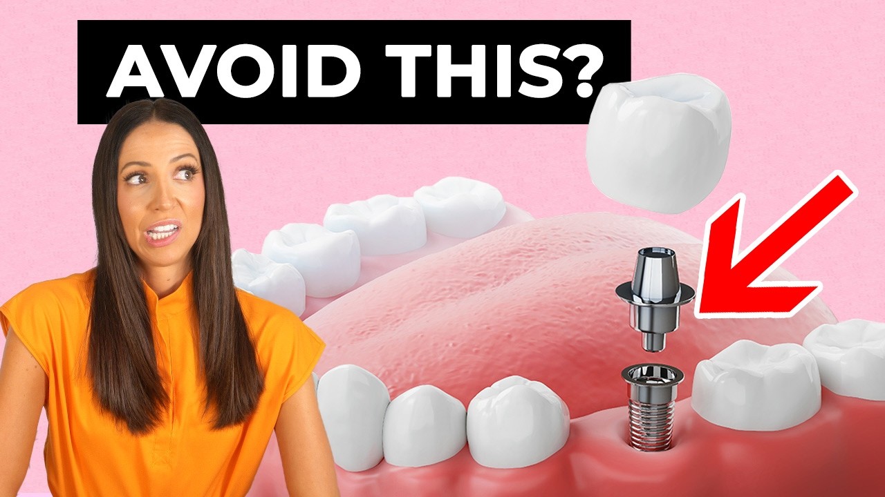 You are currently viewing Should You Avoid Dental Implants? Here’s What You Need to Know