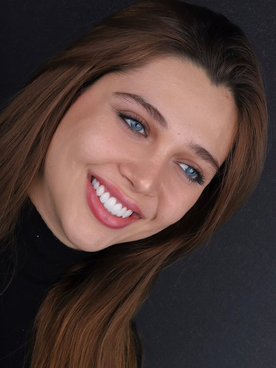 Smile makeover Colombia porcelain veneers detailed view