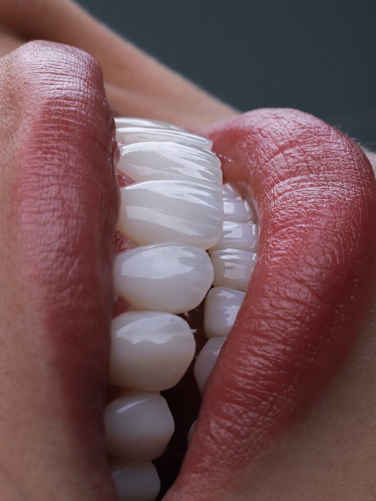 Read more about the article Are Veneers Bad for Your Teeth? Long-Term Effects, Sensitivity & Safety (2026 Guide)